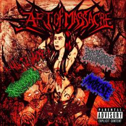 Severity (BLZ) : Art of Massacre